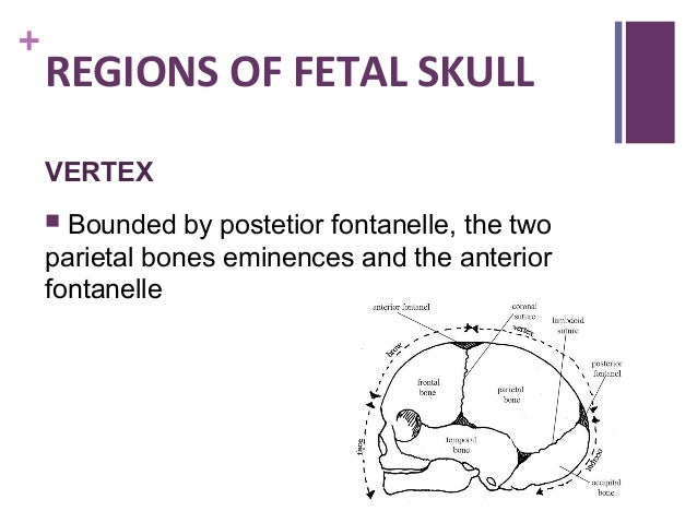 fetal skull Abnormal Fetal Head Shape regions of fetal skull vertex bounded by postetior fontanelle, the two parietal bones eminences and the anterior fontanelle